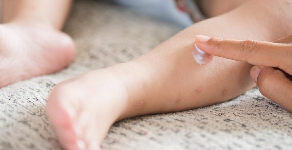 Protéger votre bébé des moustiques : conseils et astuces